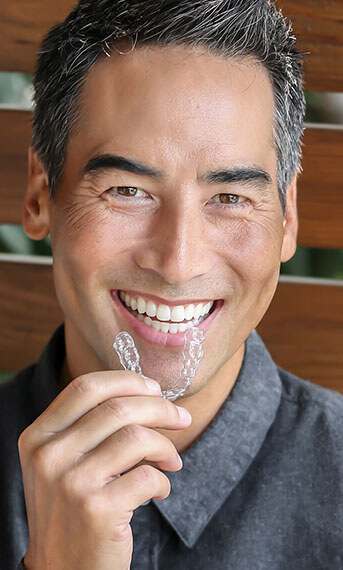 Spark clear aligners Spark clear aligners